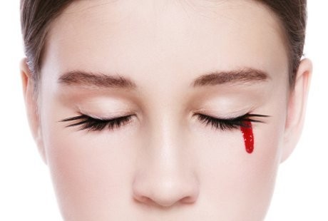 Aneh Tapi Nyata, 6 Orang Berpenyakit Misterius yang Bisa Menangis Darah