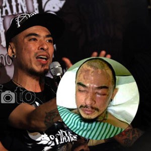 Saint Loco Berharap Penyiraman Air Keras pada Barry Salah Sasaran