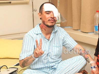 Ini Kondisi Terkini Barry Saint Loco