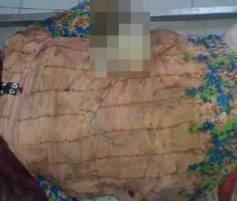 Polisi akan Sebar Sketsa Wajah Mayat Wanita Dalam Koper