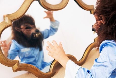 5 Manusia Serigala Sesungguhnya, Tubuh Penuh Bulu Akibat Sindrom Langka