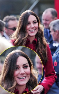 Rambut Kate tampak beruban. Carl Court - Pool/Getty Images.