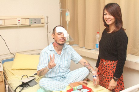 Barry Saint Loco Pilih Ampuni Pelaku Penyiraman Air Keras