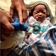 Inkubator Tak Berfungsi karena Listrik Padam, Bayi Umur 3 Hari Meninggal