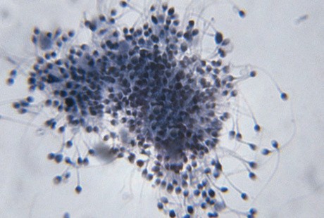 Seluk-beluk Sperma yang Perlu Diketahui