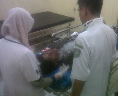 Mobil Kapolsek Tabrak Biker, Satu Orang Luka