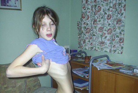 Jo Thompson Awali Perjuangan Lawan Anoreksia dengan Kerja di Restoran