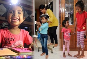 Penyakit Langka, Bocah Usia 8 Tahun Tubuhnya Hanya Sebesar Anak 3 Tahun