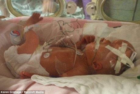 Kaydence, Bocah dengan Bentuk Kepala Tak Beraturan Karena Sindrom Langka