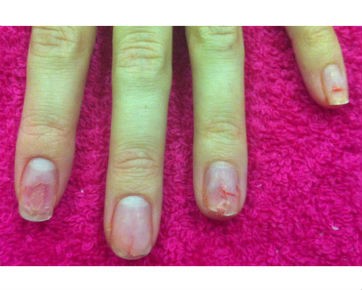 Ini Bahaya Memasang Kuku Palsu Dan Menghias Dengan Gel Polish wolipop detikcom