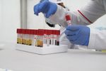 Begini Rasanya Menunggu Hasil Tes HIV, Penasaran Tapi Takut Juga