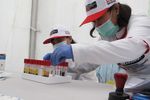 Begini Rasanya Menunggu Hasil Tes HIV, Penasaran Tapi Takut Juga