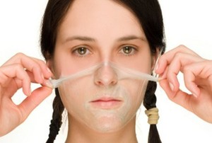Bahaya Chemical Peeling