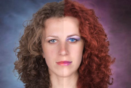 Manusia Bunglon, Kulitnya Berubah Warna karena Kondisi Langka