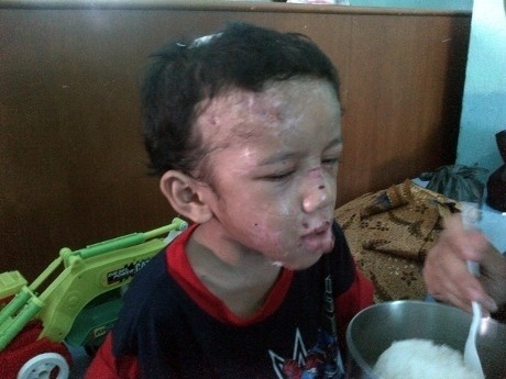 Adit Malam Ini Sudah Bisa Tertawa Nonton Upin Ipin