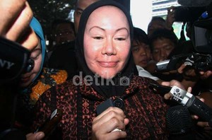 Ngaku Sakit, Atut Batal Lantik Wali Kota Tangerang
