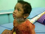 Adit Bocah Penuh Luka Dirawat di RSUD Bangkinang