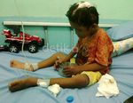 Adit Bocah Penuh Luka Dirawat di RSUD Bangkinang