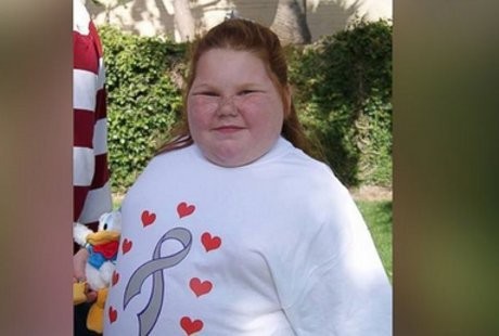 Pasca Operasi Tumor Otak, Anak Ini Jadi Ingin Makan Terus Menerus