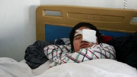 Duh! Bocah China Ditampar Teman-teman Sekelas Atas Perintah Guru