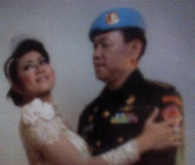 Citra Ria KDI Lebam dan Biru-biru Akibat Kekerasan Suami