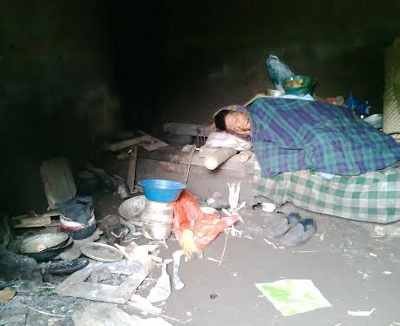 Kisah Penderita Kusta Dikucilkan, Sarep Bertahan Hidup dengan Makan Tikus