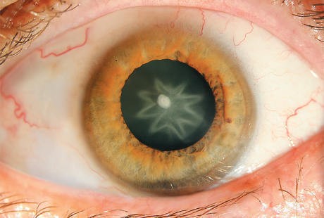 Kesetrum, Mata Pria Ini Jadi Ada Bintangnya