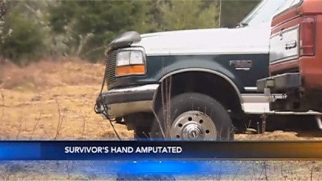 Tangan Nenek Diamputasi Setelah Terjepit Kap Mesin