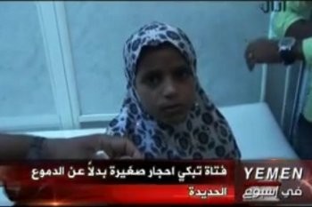 Saadiya Saleh, Gadis Berpenyakit Aneh yang Keluarkan Air Mata Batu