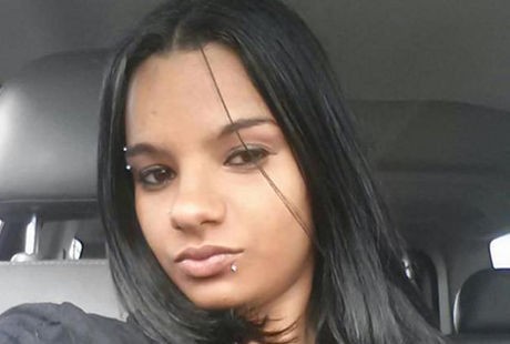 Operasi Pembesaran Payudara, Otak Ibu Muda Ini Malah Rusak dan Lumpuh