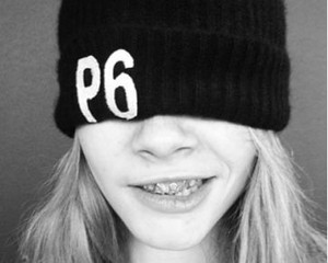 Ikuti Tren, Cara Delevingne Pamer Gigi Emas