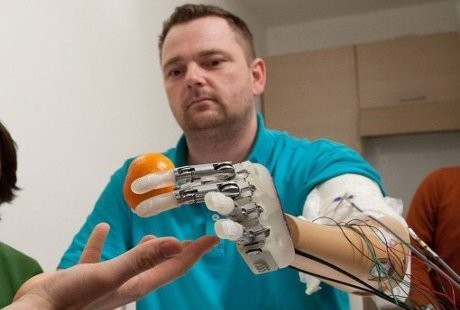 Tangan Bionik, Tangan Palsu yang Bisa Merasakan Tekstur dan Ukuran Sesuatu