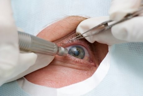 Katarak Masih Tinggi di Indonesia, JEC Tawarkan 400 Operasi Gratis