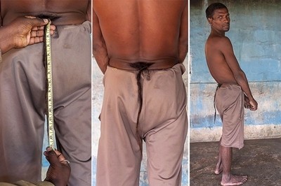 Chandre Oraon, Pria Asal India dengan Ekor 36,8 Cm