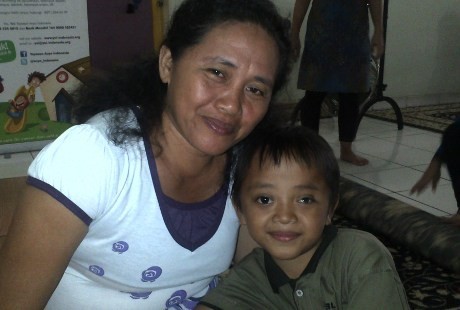 Kisah Timothy, Bocah dengan Kanker yang Bola Matanya Sering Lepas