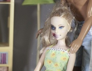Boneka Barbie Disiksa Seniman, Mata Lebam Sampai Bibir Berdarah