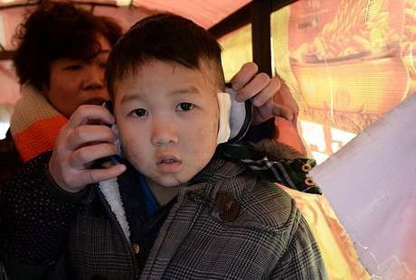 Karena Perselisihan Keluarga, Bibi Tega Potong Telinga Keponakan