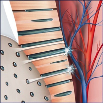 Deteksi Gigi Sensitif Dengan Cara Ini