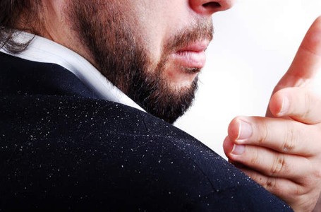 Jeruk Bisa Atasi Ketombe dan Membuat Rambut Bersinar Alami