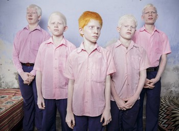     Juara pertama kategori People Staged Portrait dimenangkan Brent Stirton dari Afrika Selatan. Menampilkan sekelompok anak albino tuna netra di India.