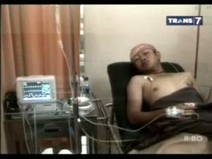 Sadis! Anggota Geng Motor Kuliti Kepala Korbannya