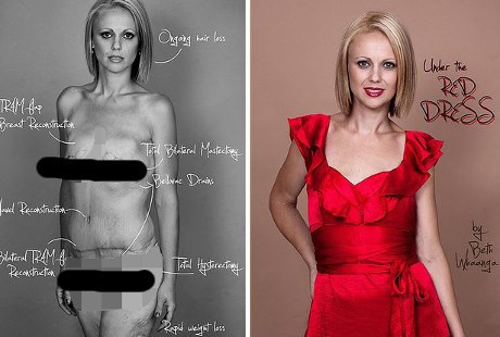 Kampanye Peduli Kanker, Ibu 4 Anak Unggah Foto Topless di Facebook