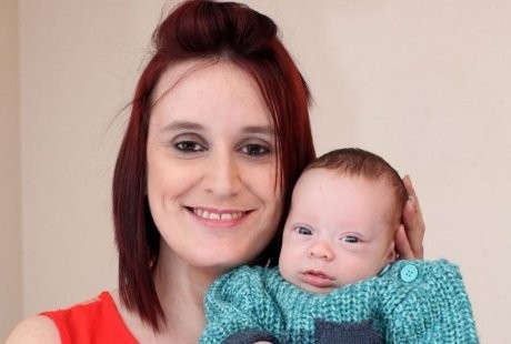 Alfie Bertahan Hidup Meski Kekurangan Cairan Ketuban Saat di Kandungan