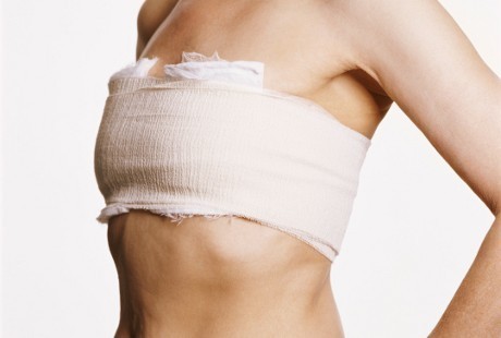 Mana Paling Efektif Deteksi Kanker Payudara: Mammografi atau Sadari?