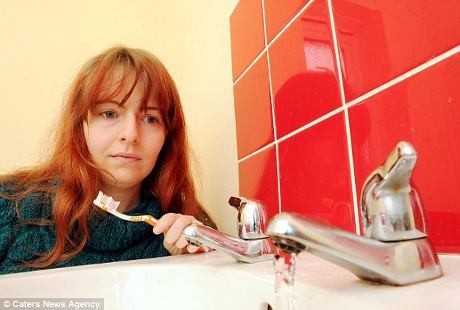 Alergi Air, Rachel Selalu Kesakitan Tiap Mandi dan Minum