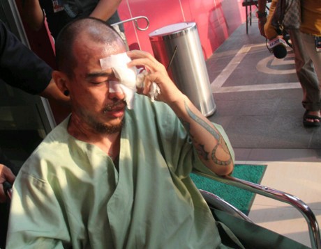 Apa Kabar Kasus Penyiraman Air Keras Barry Saint Loco?