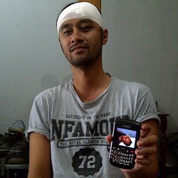 Gunakan Seragam, Polisi tak Tahu Siapa yang Pukul Iyo Pure Saturday