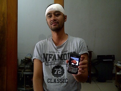 Vokalis Pure Saturday Cerita Soal Pemukulan Dirinya oleh Oknum Polisi