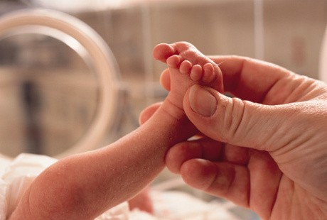 Bayi Kembar di Solo Terserang Penyakit Langka Aligale Syndrome