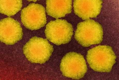 Penyakit Misterius yang Gejalanya Mirip Polio Ini Bisa Sebabkan Kelumpuhan